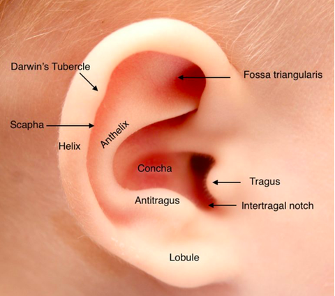 Helix deformities | Helical rim ear correction baby - EarWell.eu